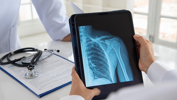 Ученые улучшили "зрение" рентгеновских аппаратов